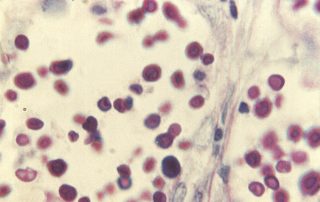 A 1964 Earthquake Might Have Unleashed a Deadly Fungus on the Pacific Northwest